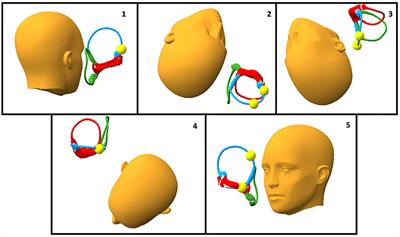 Short CRP for Anterior Canalithiasis: A New Maneuver Based on Simulation With a Biomechanical Model